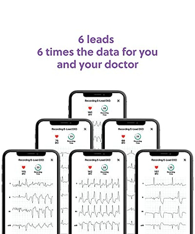 Image of KardiaMobile 6-Lead Personal EKG Monitor + 6 Arrhythmia Detections | Doctor Recommended | Detects AFib and PVCs | Medical-Grade and FDA-Cleared