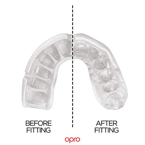 Image of OPRO Self-Fit GEN4 Gold - Pearl Blue/Pearl Mouth Guard