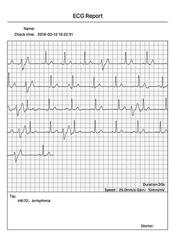 Image of CONTEC Portable ECG/EKG Monitor PC Software Electrocardiogram Bluetooth Heart Rate Beat LCD Monitor PM10