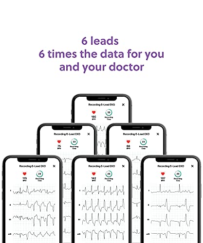  KardiaMobile 6-Lead Personal EKG Monitor – Six Views of The  Heart – Detects AFib and Irregular Arrhythmias – Instant Results in 30  Seconds – Works with Most Smartphones - FSA/HSA Eligible : Sports & Outdoors