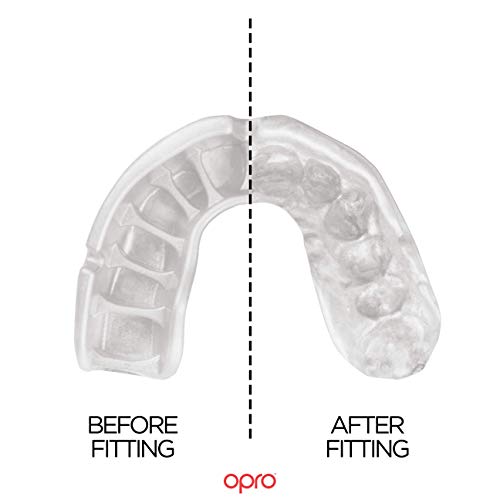 OPRO Self-Fit GEN4 Gold - Pearl Blue/Pearl Mouth Guard