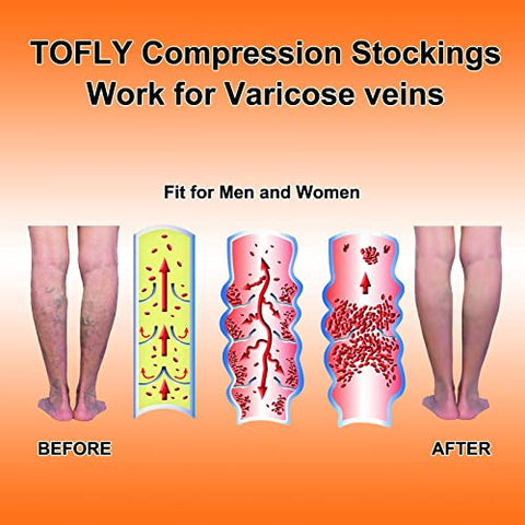 Image of Knee High Compression Stockings, TOFLY Firm Support 20-30mmHg Opaque Maternity Pregnancy Compression Socks, Open-Toe, Ankle & Arch Support, Swelling, Varicose Veins, Edema, Spider Veins, 1Pair Beige M